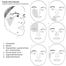 Image result for Forehead Regional Block