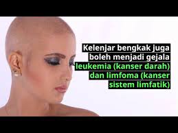 Petua hilangkan selsema dengan cara lain. Bengkak Kelenjar Swollen Lymph Node Punca Benjolan Dan Mengatasinya