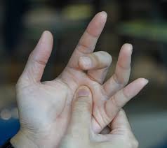 Image result for Trigger Finger