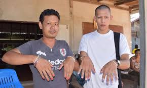 Men In Rural Thai Village Painting Their Nails Red To Avoid Being Killed By Thirsty Widow Ghost Coconuts Bangkok Did you know your nails can reveal clues to your overall health?