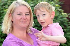 Nuneaton boy who survived being born with his brains sticking out of a hole  in his head