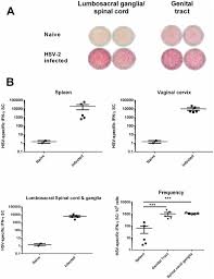 Not a single herpes reference. Virus Specific Immune Memory At Peripheral Sites Of Herpes Simplex Virus Type 2 Hsv 2 Infection In Guinea Pigs