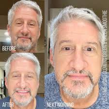 These anti wrinkle undereye pads from @wrinklesschminkles are my favorite  way to pamper myself while getting ready for the day. Each pair is reusable  up to 10 times and your skin can