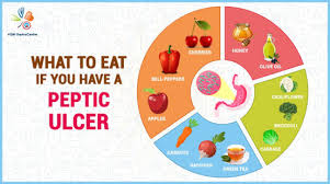 The most common peptic ulcer symptom is burning stomach pain. What To Eat If You Have A Peptic Ulcer Stomach Ulcer Vgm Gastro Centre