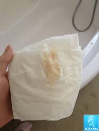 Last Van Bruine Afscheiding Of Slijm Tijdens De Zwangerschap