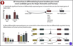 Check spelling or type a new query. Chromatin Interactions In Differentiating Keratinocytes Reveal Novel Atopic Dermatitis And Psoriasis Associated Genes Journal Of Allergy And Clinical Immunology