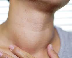 Yoga poses for thyroid stimulation. This Yoga Pose Will Help With Your Thyroid Problem Suggests Expert