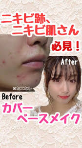 わたし自身 口周りに吹き出物ができやすく普段から行なっているカバーメイク方法です ニキビ メイク ニキビ ファンデーション ニキビ肌