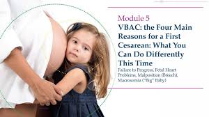 Image result for Failure to Progress