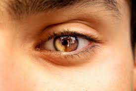 The War Had Begun But Alex Was The Only One Having A War Already Within Himself His Wolf Being Was Turning Into Ag Heterochromia Eyes Amber Eyes Pretty Eyes