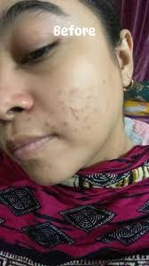 Hi guys! Wondering if anyone has any amazing tips to get sudo cream off the  couch??? Desperate for a solution 🙊