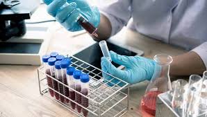 Anadolu sağlık merkezi mikrobiyoloji uzmanı dr. Corona Korona Antikor Testi Nedir Anadolu Saglik Merkezi