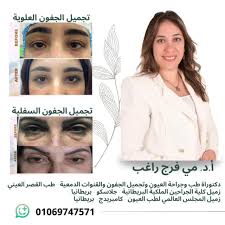 Transcutaneous Lowerlid Blepharoplasty # تجميل الجفون السفلية قبل العمليه  فيه انتفاخات دهنيه تحت العين مع ترهل في الجلد وتم ازاله الانتفاخات والجلد  المترهل والنتيجة بعد شهر من العلاج والمتابعه 🌟د. مي فرج