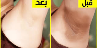 تجربتي مع بيكربونات الصوديوم للمنطقه Alaylalayl