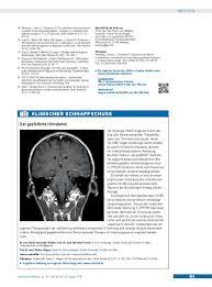 The article provides a detailed review of the literature resources. Der Gepfefferte Hirnstamm