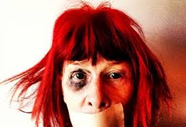 She has been married to roberto de carvalho since december 13. Rita Lee Aparece Amordacada E Com O Olho Roxo Ofuxico