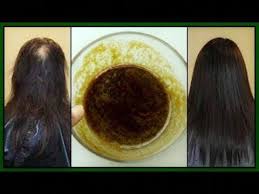 Extreme Hair Growth Get Rid Of Balds Spot Splits Ends Scalp Psoriasis Hair Growth Treatment Thick Hair Remedies Extreme Hair Growth