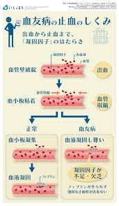 血友病の止血のしくみ infographics 看護ノート 治療 医療