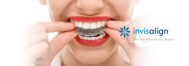 Practicing taking the aligner out and replacing it. Invisalign Treatment In Our Clinic