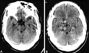 The Basic Principles Of Computed Tomography And Magnetic Resonance Imaging Journal Of The American Academy Of Dermatology