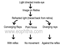 Image result for Refractive Error