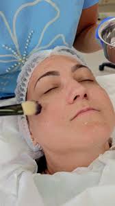 Aplicarea acidului glicolic în peeling-ul chimic, ORĂ DE CURS, #Styllia  #Class, #cursul de #cosmetician #calificare, #diplome #recunoscute  #national #international, #emise de #Ministerul #Muncii și ...