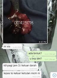1 bulan 2 bulan 3 bulan 4 bulan 5 bulan menjual ubat pengguguran di farmasi. Ubat Gugur Cytolog Cytotec Mtp Kit 017 4251718 Ubat017 Twitter