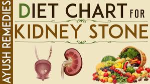 Kidney Stone Diet List Of Foods To Eat And Avoid During