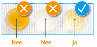 U krijgt in overleg met uw arts binnenkort een darmonderzoek. Coloscopie Lumc