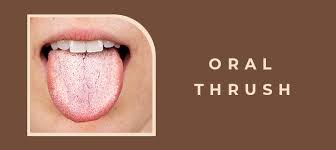 Image result for brown tongue symptoms