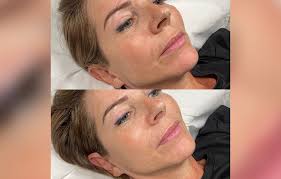 Skin'Art Beauty & Tattoo Concept unique en Suisse comunicato stampa nuove  informazioni