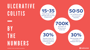 The symptoms of ulcerative colitis vary from person to person and about half of all ulcerative colitis patients experience mild symptoms. Ulcerative Colitis Symptoms Treatments Causes And More