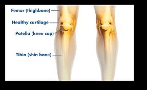 Knee Pain Common Causes And Symptoms Stryker