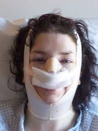 Der exzentrische designer harald glööckler (55) steht ganz offen zu seinen zahlreichen operationen und auch andere promis machen kein geheimnis aus ihren getunten bodys. Kader Loth Uncyclopedia