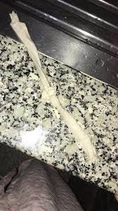 4 استفراغ رغوة بيضاء بعد. Ø§Ù„Ø±Ø§Ù‚ÙŠ Ø§Ù„Ø´Ø±Ø¹ÙŠ Ù‡Ø´Ø§Ù… Ø§Ø¨Ùˆ Ø§Ø³ÙŠØ© Ø¨Ø®Ø§Ø±ÙŠ Ø¨Ø§Ø­Ø« ÙÙŠ Ø¹Ù„Ù… Ø§Ù„Ø±Ù‚ÙŠØ© Ø§Ù„Ø´Ø±Ø¹ÙŠØ© Publicaciones Facebook