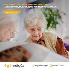 Genellikle Ileri Yaslarda Gorulen Ve Ciddi Gorme Kaybina Neden Olan Katarak Hastaliginin Femtosaniye Lazer Cerrahisi Ile Tedavisi Uzman Goz Hek Gozler Teknoloji