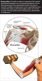 Image result for Biceps Tendon Injection