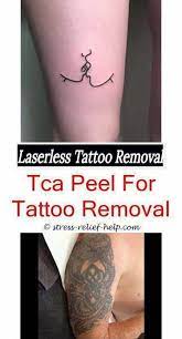 Cosmetic Tattoo Removal How Does Tattoo Removal Work Yahoo How Much Does It Cost To Remove Small Tattoos Low Cost Tattoo Removal How Much Is A Tattoo Removal