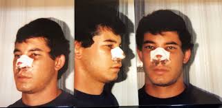 The Topology of My Face