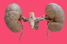 Ostial renal artery stent placement for atherosclerotic renal artery stenosis in patients with coronary bavishi c., peter w de leeuw , messerli f. 1 Bifurcation Of The Renal Artery Aortography A Abdominal Part Of Download Scientific Diagram