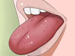 Maybe you would like to learn more about one of these? Ù‡Ù„ ÙˆØ®Ø² Ø§Ù„Ù„Ø³Ø§Ù† Ù…Ù† Ø§Ø¹Ø±Ø§Ø¶ Ù†Ù‚Øµ Ø§Ù„ÙÙŠØªØ§Ù…ÙŠÙ†Ø§Øª Ø§Ù„Ù…Ø±Ø³Ø§Ù„