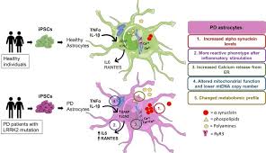 Parkinson disease, degenerative neurological disorder characterized by the onset of tremor, muscle rigidity, slowness in movement, and stooped posture. Study Links Brain Astrocyte Dysfunction To Parkinson S Disease Pathology