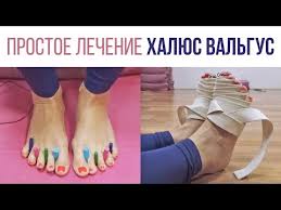 косточка на большом пальце ноги лечение в домашних условиях Halyus Valgus Lechenie Bez Operacij V Domashnih Usloviyah Youtube V 2020 G Trenirovochnye Uprazhneniya Zdorove Domashnyaya Trenirovka