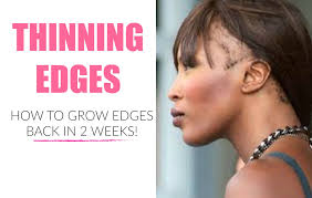 Perhaps your hair loss is due to a vitamin deficiency. Get Practical Tips To Regrow Your Thinning Edges Fast