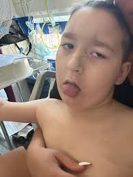 My Beautiful Boy Bleu 💙 Yesterday we fought long and hard. 17 hours to be  precise in a&e of non stop work