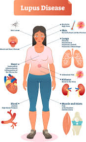 Pin On Healthy Stuff