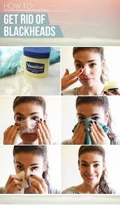 Ddg Diy How To Get Rid Of Blackheads At Home Skin Care Beauty Remedies Health And Beauty Tips