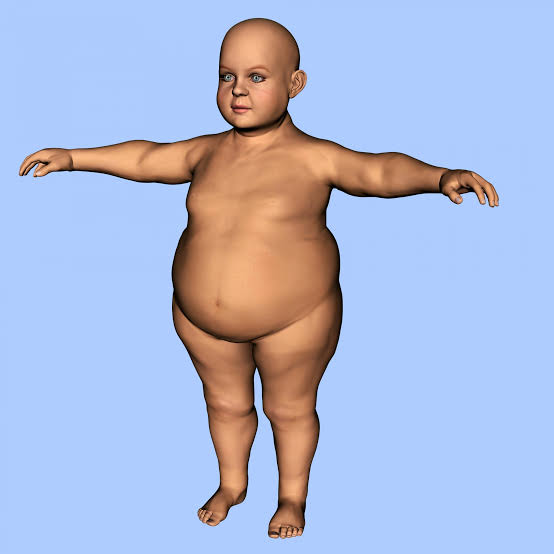 overweight child"