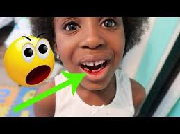 See full list on wikihow.com How To Pull Out A Loose Painlessly Youtube