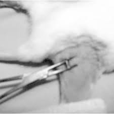 Identify charvel model, charvel models, charvel serial numbers, charvel serial number lookup, charvel guitar models Diseccion Quirurgica Del Nervio Ciatico Figura 1 Imagen Del Modelo Download Scientific Diagram